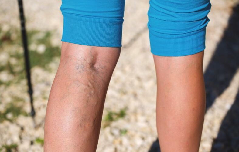 Az alsó végtagok károsodása