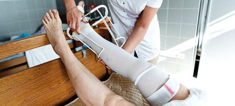 kompressziós harisnya visszerek kezelésére